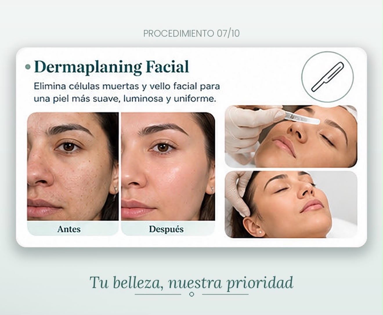 Información visual sobre el procedimiento de dermaplaning facial