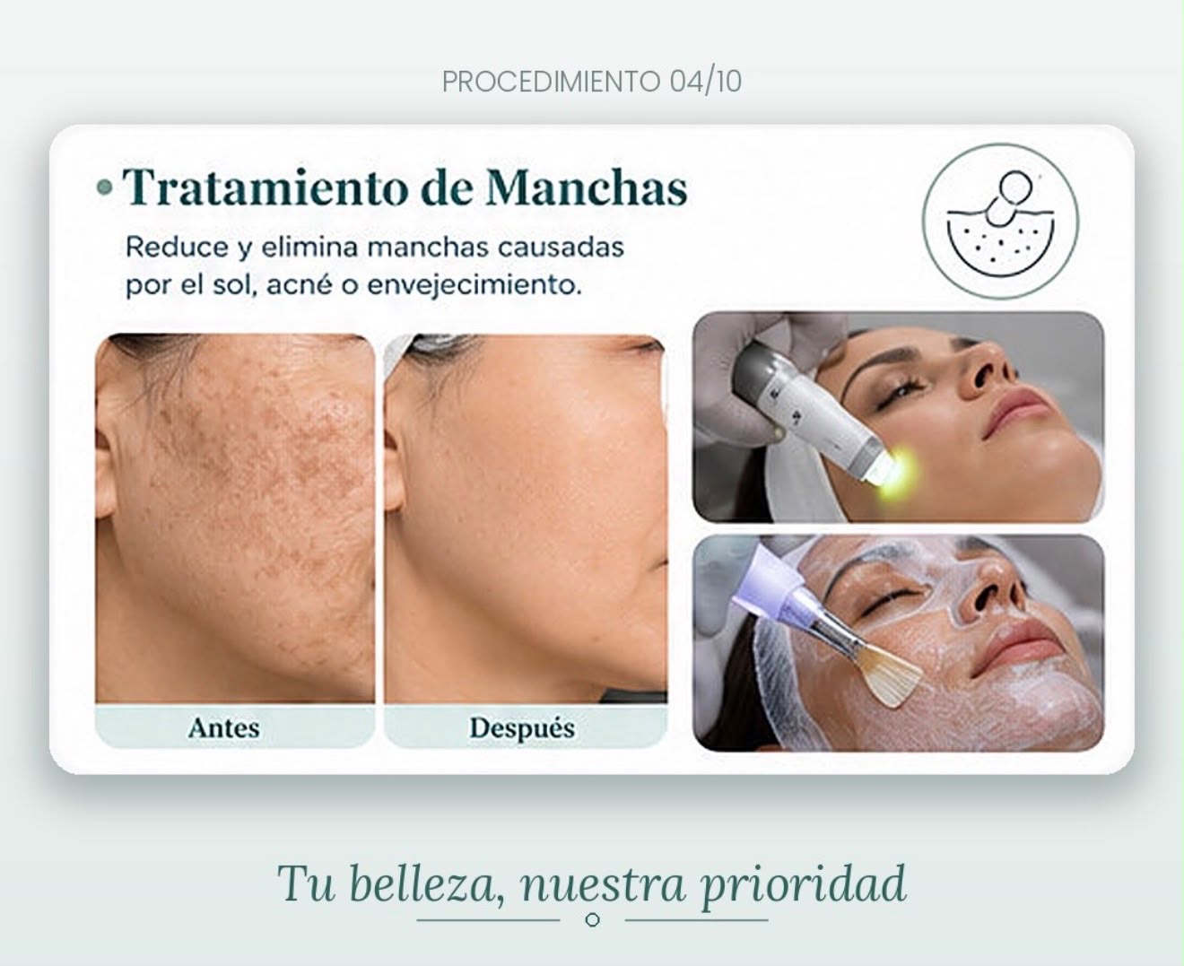 Información visual sobre el tratamiento de manchas faciales
